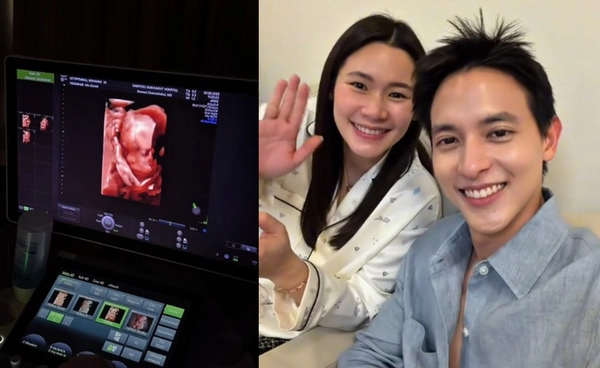 เปิดภาพอัลตร้าซาวด์ลูก “เจมส์ จิรายุ” อัปเดต “โฟม” ท้อง 23 สัปดาห์ 