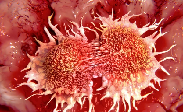 ยารักษาที่ภูมิคุ้มกัน ออกฤทธิ์กำจัดมะเร็งในกระเพาะปัสสาวะ โดยไม่ต้องใช้เคมีบำบัด