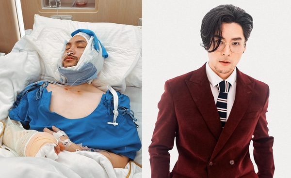 "ทอม อิศรา" ประสบอุบัติหนัก ทำให้กระดูกคางหัก ตับ-ไตฉีก กระดูซี่โครงร้าว