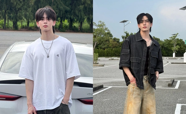 แฟนคลับส่งกำลังใจ “แซนต้า พงศภัค” ประสบอุบัติเหตุกระดูกข้อมือหัก