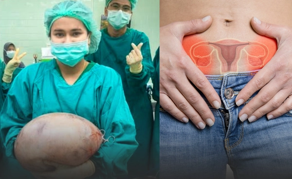 ผ่าซีสต์รังไข่ 8 กก. ฝีมือทีมผ่าตัดรพ.สตูล 