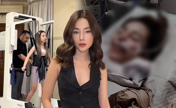 อินฟลูอินโด แชร์อุทาหรณ์ชัก 12 ชม. โคม่านับเดือน เหตุทำศัลยกรรมไร้วิสัญญีแพทย์