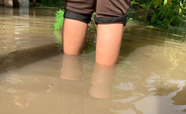 เตือน "ไข้ดิน" ช่วงน้ำท่วม เสียชีวิตแล้ว 72 ราย เปิด 5 จังหวัดป่วยสูงสุด