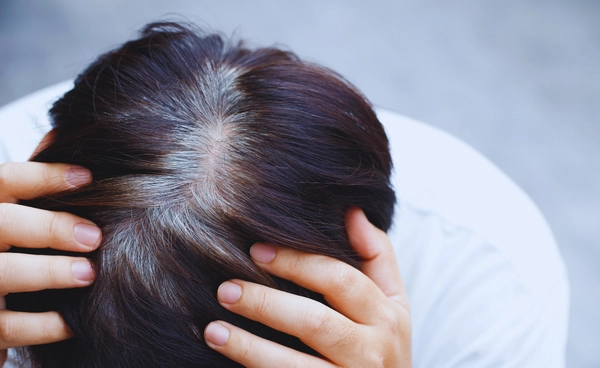 วิจัยญี่ปุ่นชี้ ผมขาว อาจเป็นสัญญาณว่าร่างกายกำลังสู้กับมะเร็ง