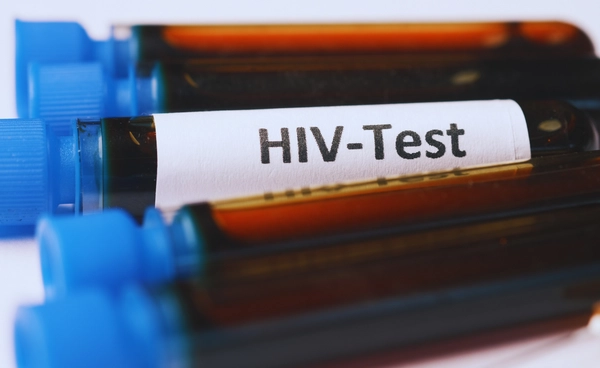 ชายคนที่ 7 ของโลก ปลอดเชื้อ HIV หลังได้รับการปลูกถ่ายสเต็มเซลล์