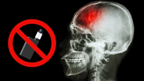 วิจัยเผยสูบบุหรี่ไฟฟ้า เพิ่มความเสี่ยง โรคหลอดเลือดสมอง อัมพาตเฉียบพลัน 