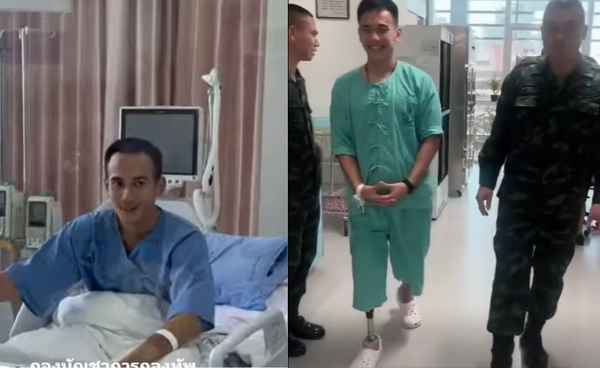 ส่งกำลังใจ หมวดบุ๊ค  วีรบุรุษปราสาทตาควาย ใส่ขาเทียม เริ่มหัดเดิน