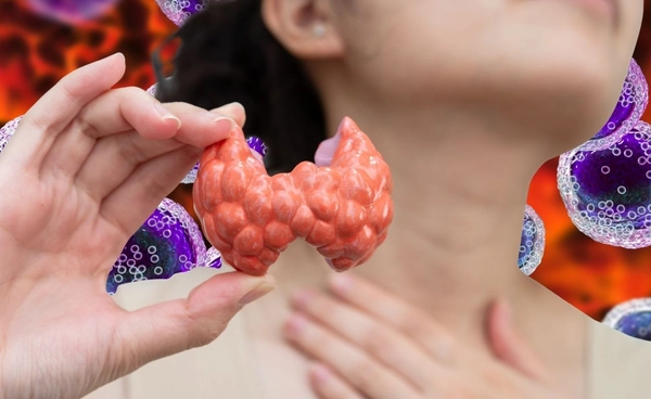 คนไทยป่วยมะเร็งต่อมน้ำเหลืองพุ่งเกือบ 2 เท่าใน 7 ปี