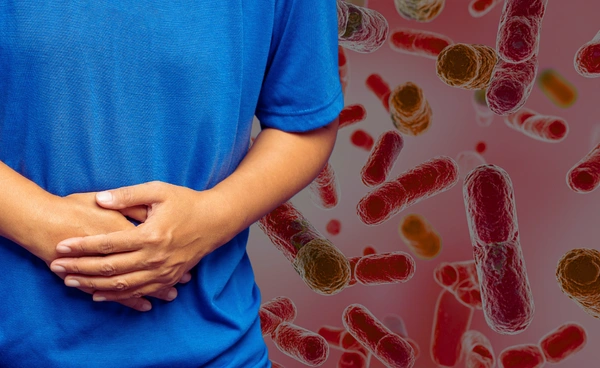 แบคทีเรียใหม่อาจก่อโรคลำไส้ใหญ่อักเสบเรื้อรังชนิดเป็นแผล