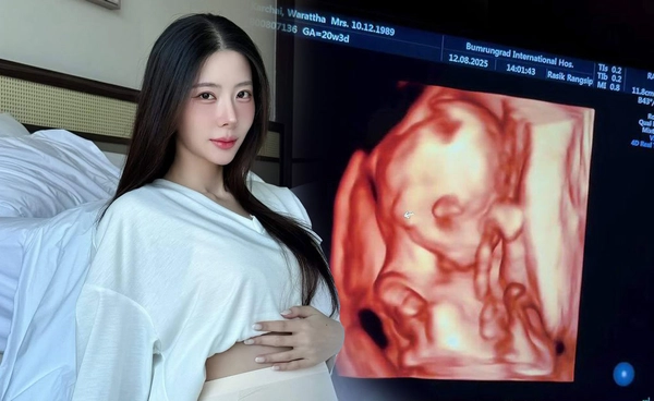 เนย วรัฐฐา เปิดภาพแรก! เบบี๋วัย19สัปดาห์ สุดตื่นเต้นรอพบหน้า