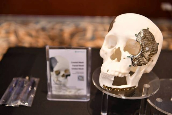 นวัตกรรม "กระดูกเทียมไทเทเนียม" ช่วยทหารกล้าชายแดน