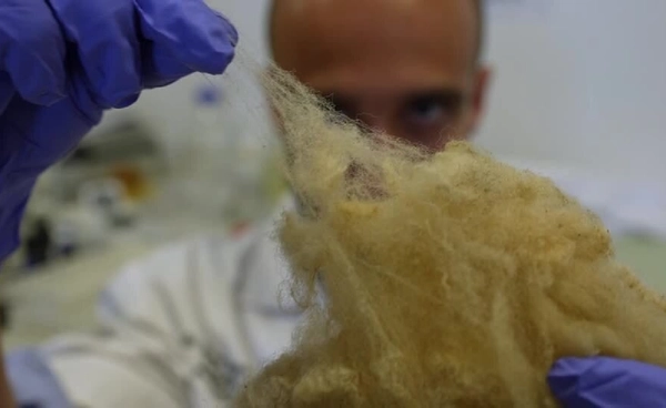 ทันตกรรมอังกฤษสุดเจ๋ง ใช้เคราตินจากเส้นผม เคลือบฟันแทนสารสังเคราะห์