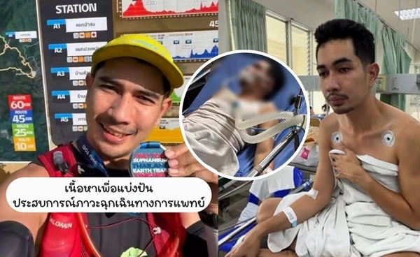 หนุ่มแชร์ประสบการณ์ภาวะกล้ามเนื้อสลายเกือบไม่รอด เหตุจากวิ่งเทรล 60 กิโล