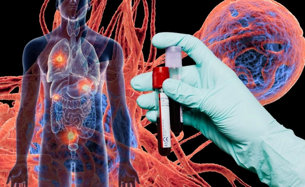 นักวิทย์ฯ พัฒนาชุดตรวจเลือดหามะเร็งได้ถึง 14 ชนิด แม่นยำ 95 เปอร์เซ็นต์