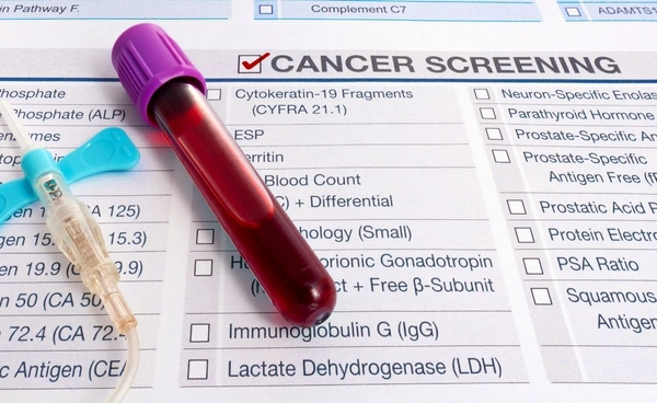 นักวิจับเผยการตรวจเลือดแบบใหม่ พบมะเร็งได้ก่อนแสดงอาการถึง 3 ปี
