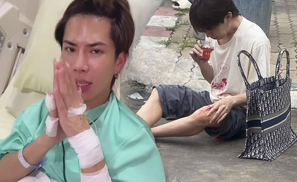 เอม ตามใจตุ๊ด เปิดภาพวันเกิดอุบัติเหตุ เตือนตัวเอง หลังจากนี้อย่าประมาท