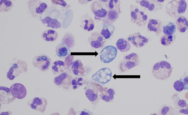 ส่องนวัตกรรม “AI Bio-Tech” รับมือภัยเงียบจากน้ำประปา หลังพบกรณี "อะมีบากินสมอง" คร่าชีวิตหญิงชาวสหรัฐฯ