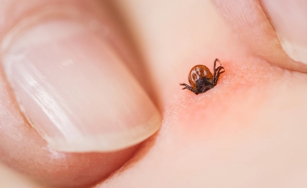 เห็บกัด! หมอยง เตือนโรคไข้สูงเกล็ดเลือดต่ำ ไทยพบเสียชีวิตแล้ว 2 ราย