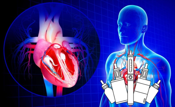 บุหรี่ไฟฟ้า เพิ่มความเสี่ยงหัวใจขาดเลือด อันตรายถึงชีวิต วิจัยชี้