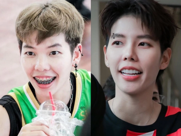  โดนบูลลี่มาทั้งชีวิต "ป๊ายปาย" ยึดอกรับผ่าตัดเหงือก คู่จิ้น นุ๊ก อวยยศ ทำสวยเตรียมลงมิสแกรนด์