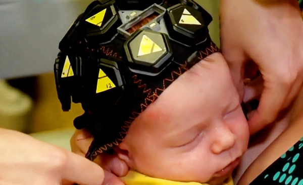 รวมเด็ด 5 นวัตกรรมเพื่อการแพทย์ จากแขนกลถึง AI ช่วยวินิจฉัยโรค