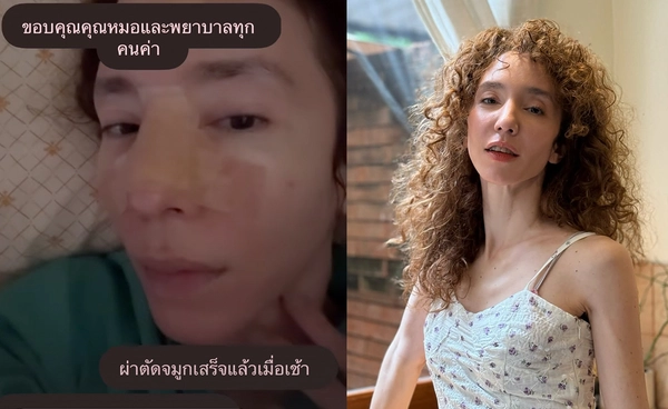 เจ็บอยู่ แต่ไหว! “คลาวเดีย” ประสบอุบัติเหตุ วูบล้มหัวฟาด เย็บ 35 เข็ม