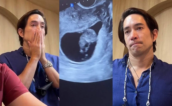 นุ่น รมิดา แชร์ภาพวินาทีที่คุณพ่อรอคอย หลุยส์ สก๊อต เห็นลูกครั้งแรก!