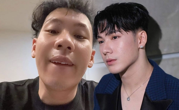 เปิดภาพล่าสุด ตั้ม วราวุธ หลังเกิดอุบัติเหตุหนัก เจ้าตัวบอก3วันดี4วันหาย(ฟัน)