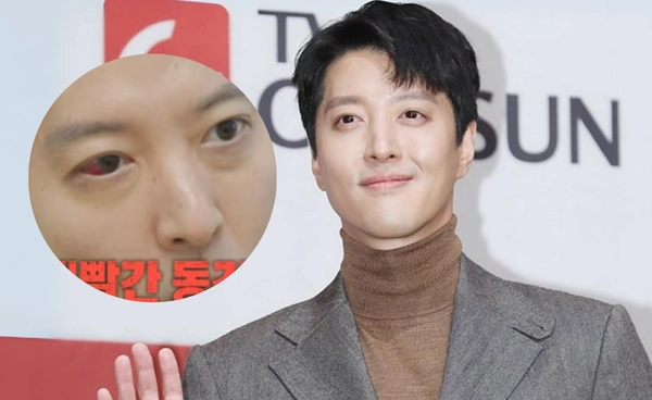 อีดงกอน พระเอกเกาหลีชื่อดังป่วยโรคหายาก พบเพียง 1 เปอร์เซนต์