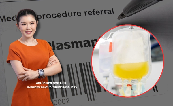 Plasmapheresis ช่วยชะลอวัยได้จริงหรือไม่?