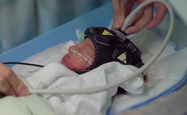 “หมวกสแกนสมองทารก” ส่องความผิดปกติสมองเด็กแรกเกิด ตั้งเป้าวินิจฉัยไวขึ้น