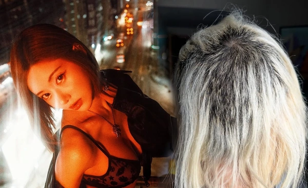 "ดีเจโซดา" ผมเสียหลังฟอกสีผมถึงขั้นต้องยอมโกนหัว