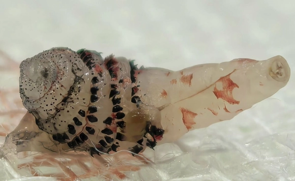 นี่ตัวอะไร อยู่ใต้ผิวหนังคนไข้นักท่องเที่ยวชาวต่างชาติ