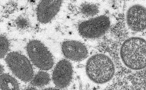 ยอดเสียชีวิต "ฝีดาษลิง" ในแอฟริกาพุ่ง 1,922 ราย นับตั้งแต่ต้นปี 2567