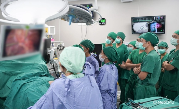 คณะแพทยศาสตร์ ม.เชียงใหม่ ประสบความสำเร็จ! ผ่าตัดปลูกถ่ายตับระหว่างคู่ฝาแฝดชาย อายุ 20 ปี