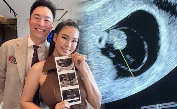 ปาย สิตางศุ์ ตั้งท้องแล้ว! สุดดีใจ เก็บไข่ถึง 5 ครั้งกว่าจะสำเร็จ