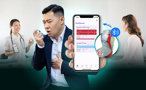 ยกระดับการควบคุมโรคหืด Smartinhaler เซ็นเซอร์ Bluetooth พลิกโฉมการใช้ยาพ่นโรคหืด