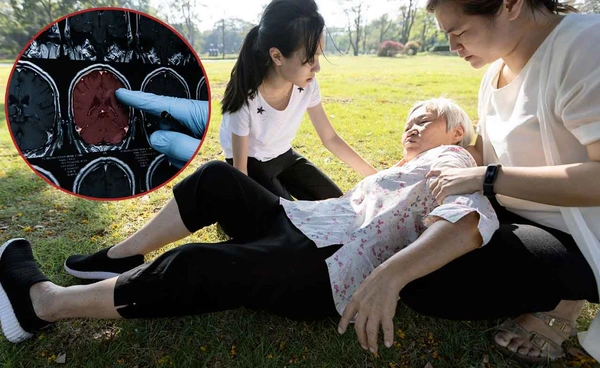 4 ชั่วโมง 30 นาที เวลาทอง ! ช่วยโรคหลอดเลือดสมองรอดชีวิต ?