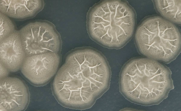 “อะมีบากินสมอง” ภัยเงียบจากน้ำธรรมชาติ แพทย์ มช. เตือนประชาชนอย่าชะล่าใจ 