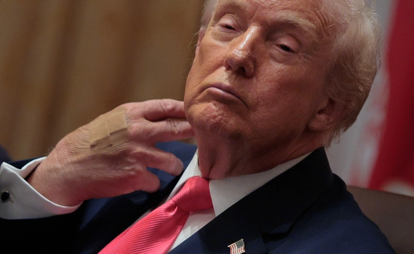 รอยช้ำใหม่มือซ้าย ‘ทรัมป์’  โผล่อีกแล้ว จุดกระแสสงสัย แพทย์ชี้ อาจไม่เกี่ยวจับมือบ่อย