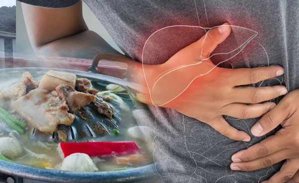 ไวรัสตับอักเสบอี ไม่ใช่โรคใหม่! หมอยง เผยผู้ป่วยหลายรายมีประวัติทาน "หมูกระทะ"