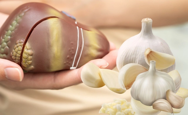 งานวิจัยชี้ กินกระเทียมสดเป็นประจำ อาจเชื่อมโยงลดความเสี่ยงมะเร็งตับ