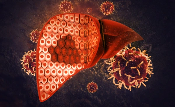 คนไทยเสียชีวิตจากมะเร็งตับปีละ 26,000 ราย รู้จักอาการเตือนที่ไม่ควรละเลย 