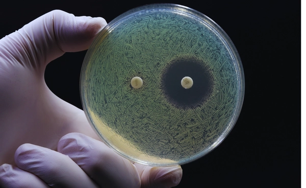 ทำไมน้ำเสียจากเครื่องบิน อาจช่วยเตือนภัยเชื้อดื้อยาได้?