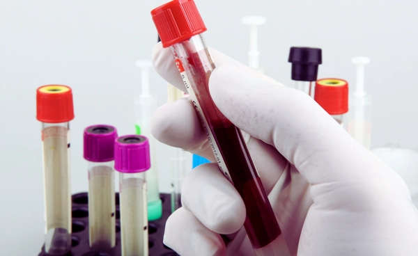 รู้จัก กรุ๊ปเลือดทองคำ หายากมากที่สุดในโลก พบเพียง 50 คน