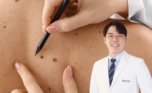 เทคนิค Mohs Surgery ผ่าตัดมะเร็งผิวหนังแบบเรียลไทม์ บางชนิดหาย 99% 
