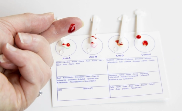 นักวิทยาศาสตร์ฝรั่งเศสค้นพบกรุ๊ปเลือดใหม่ที่ 48 ของโลก