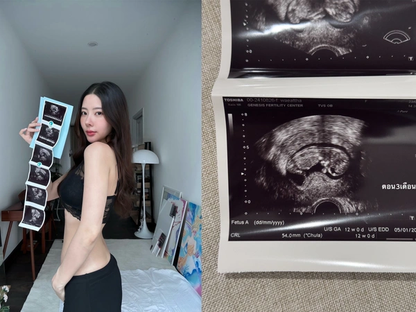 "เนย วรัฐฐา" ประกาศข่าวดีตั้งท้องลูกคนแรก หลังเข้ารับคำปรึกษาภาวะมีบุตรยาก