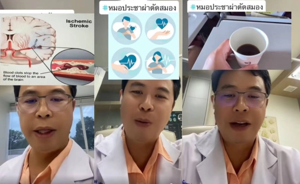 หมอเผยเคส หญิง วัย 50 ปี ดื่มกาแฟแล้วใจสั่น แขนขาอ่อนแรง ตรวจดูพบสมองขาดเลือด