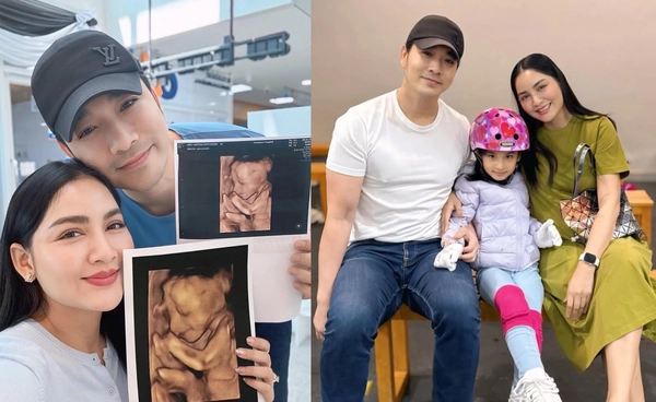 “เจมส์ เรืองศักดิ์” เผยภาพอัลตราซาวด์ลูกสาวคนที่ 2 “น้องมีเมตตา” แฟนคลับแห่ยินดี